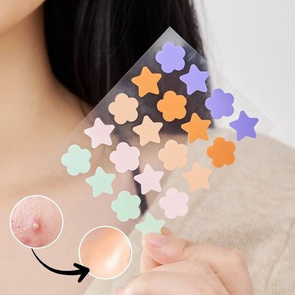 Star Pimple Patches 20 Count, Hydrocolloid Patch with Salicylic Acid, Cute Pimple Sticker, Waterproof Blemish Patch