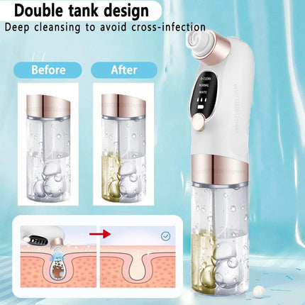 Blackhead Remover Tool Rechargeable 6 Suction Heads, Blackhead Vacuum Pore Cleaner – media 5