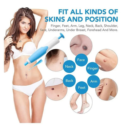 Skin Tag Removal Kit, Skin Tag Removal Tool for Face and Neck – image 5