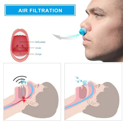 Anti Snoring Device, Micro Device to Reduce Snoring During Sleep – image 6