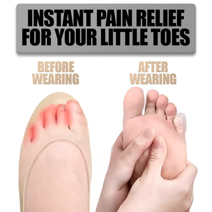 Toe Caps Silicone Gel 10 Pack, One Size Fits Most – image 7