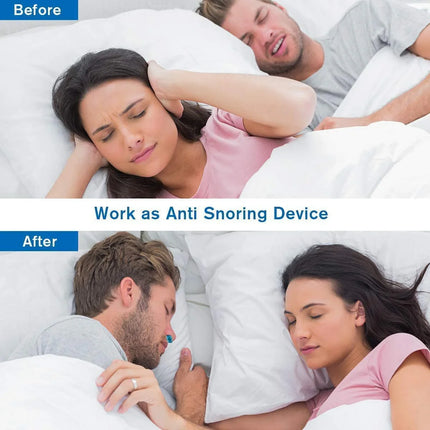 Anti Snoring Device, Compact Sleep Device Without Bulky Masks – image 7