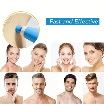 Skin Tag Removal Kit, Skin Tag Remover Pen with 40 Medical Silicone Bands – image 10