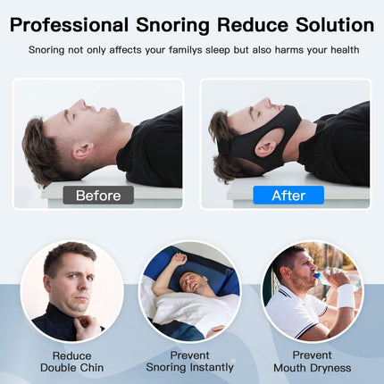 Adjustable Chin Strap for Snoring, Double-Layer Fabric
