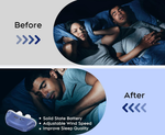 Tuzwa Anti-Snoring Nasal Device – Compact ABS & Silicone Sleep Aid, Lightweight Travel Snoring Accessory