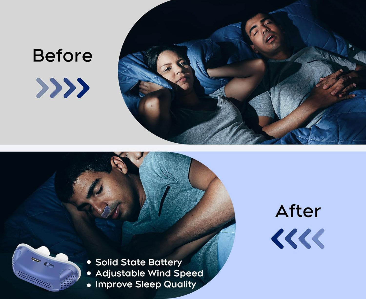 Tuzwa Anti-Snoring Nasal Device – Compact ABS & Silicone Sleep Aid, Lightweight Travel Snoring Accessory
