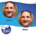 Tuzwa Clip-On Veneers – Natural-Looking Removable Cosmetic Teeth Cover for Temporary Smile Enhancement