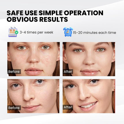 LED Face Mask with Remote and Eye Protection Pads – image 5
