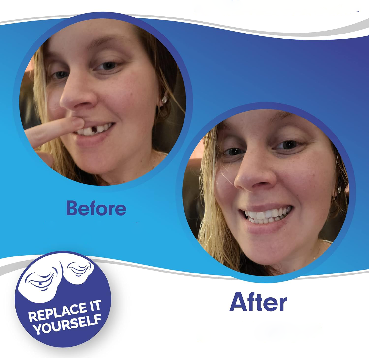 Tuzwa Clip-On Veneers – Natural-Looking Removable Cosmetic Teeth Cover for Temporary Smile Enhancement