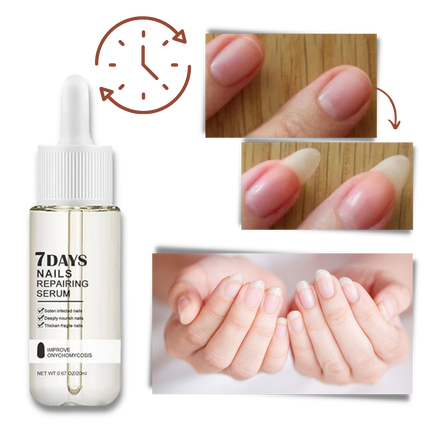 Nail Repair Essence, Nail Moisturizer Serum for Hands and Feet – image 5