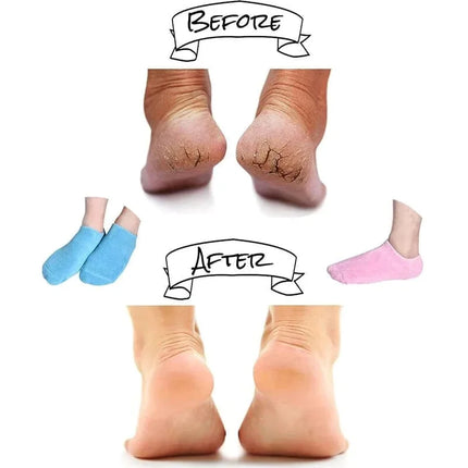 Moisturizing Socks with Spa Gel Lining, Gel Socks for Dry Cracked Heels – image 14