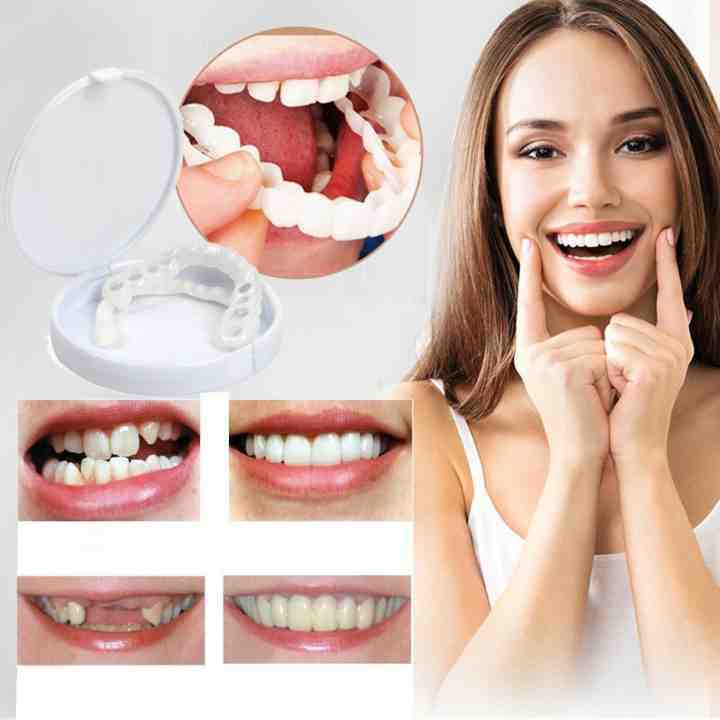 Tuzwa Snap-On Dentures – Natural-Look Temporary Teeth Cover, Adjustable Micro-Thin Reusable Cosmetic Smile Cover