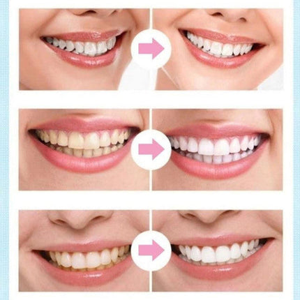 Teeth Whitening Pen, Dental Whitening Pen, Teeth Whitener