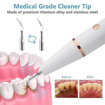 Tartar Remover for Teeth, USB Rechargeable Teeth Cleaning Tool with Dual Heads