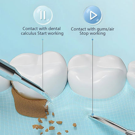 Tartar Remover for Teeth, USB Rechargeable Teeth Cleaning Tool with Dual Heads – image 5