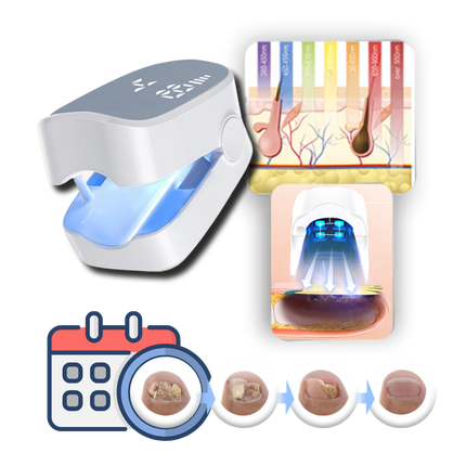Cold Laser Device for Nail Fungus, Rechargeable Portable Laser Device with Blue Light for Toenails and Fingernails, Cold