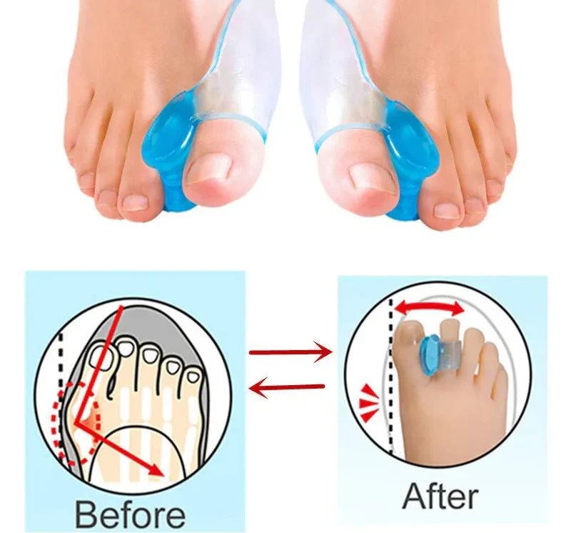 Comfort Fit | Silicone Toe Separators for Natural Alignment | Soft & Flexible Design for Daily Comfort 0