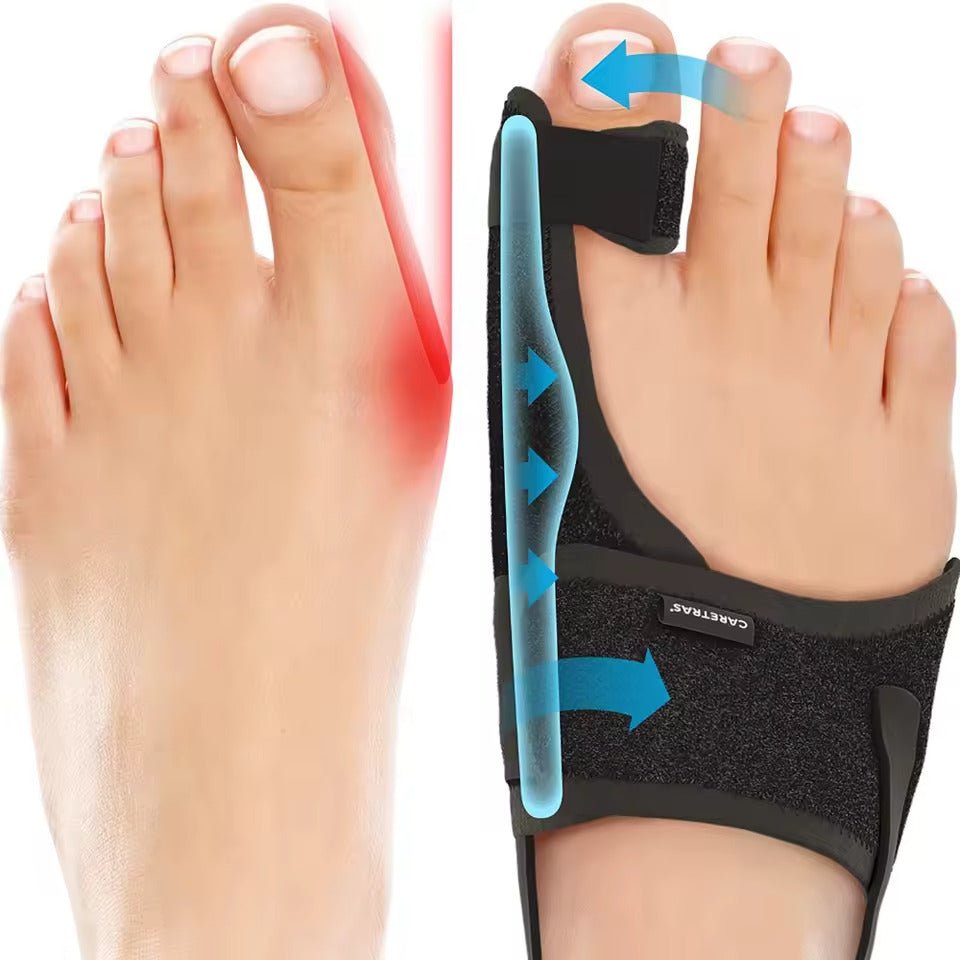 Comfort Night Splint | Adjustable Hallux Valgus Support for Pain Relief | Ergonomic Design for Better Sleep Quality 0