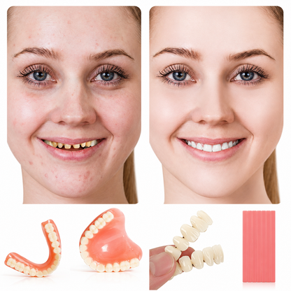 Complete Denture Kit | Natural-Looking Temporary Teeth with Custom Fit | Comfortable Solution for Smile Restoration 0