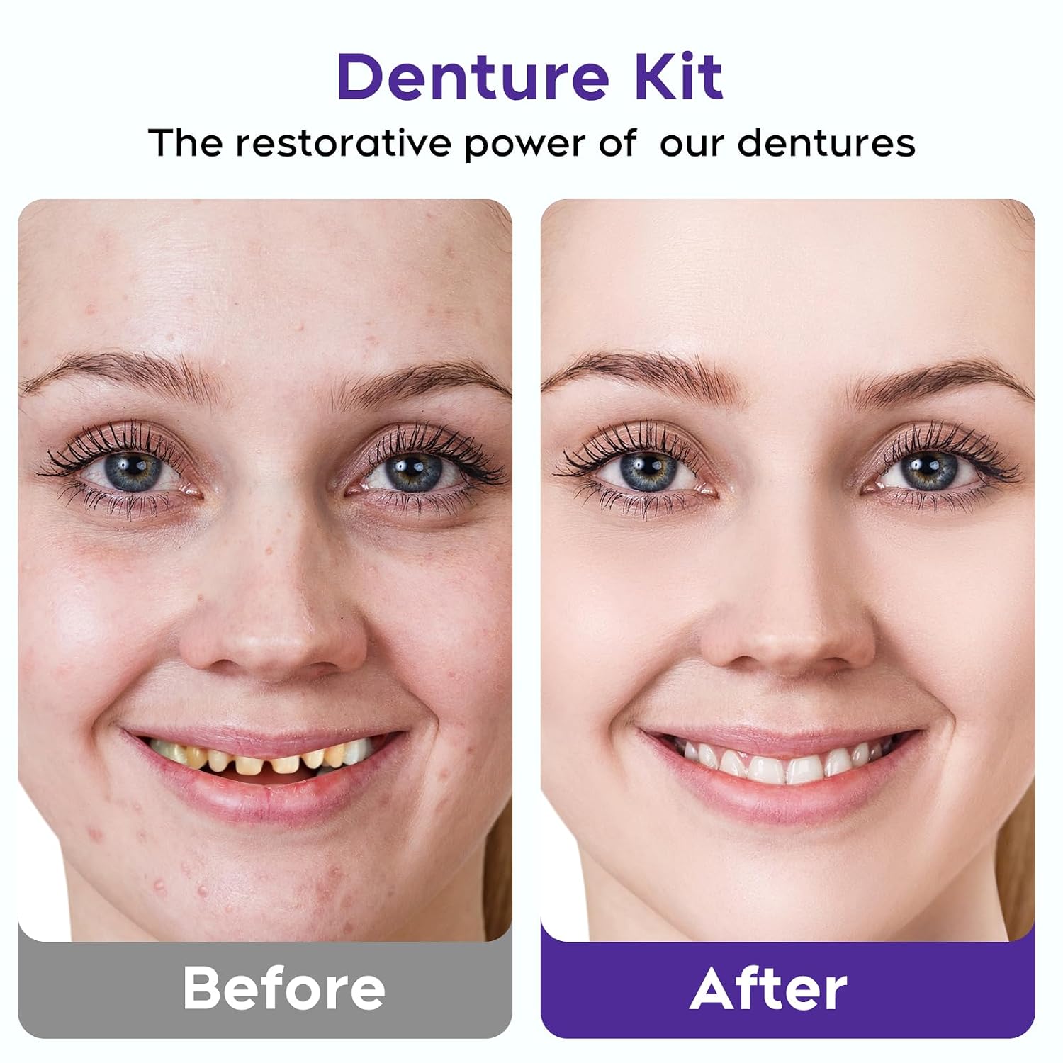 Complete Denture Kit | Natural-Looking Temporary Teeth with Custom Fit | Comfortable Solution for Smile Restoration 5