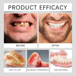 Complete Set of Dentures | Upper & Lower Temporary Fitting with Natural-Looking Design | Cosmetic Solution for Confident Smiles 5
