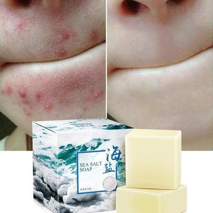Goat Milk Soap Bar with Sea Salt, Glycerin Soap for Oily and Acne Prone Skin