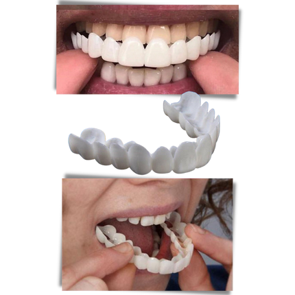 Snap On Veneers, Reusable Teeth Cover – image 5