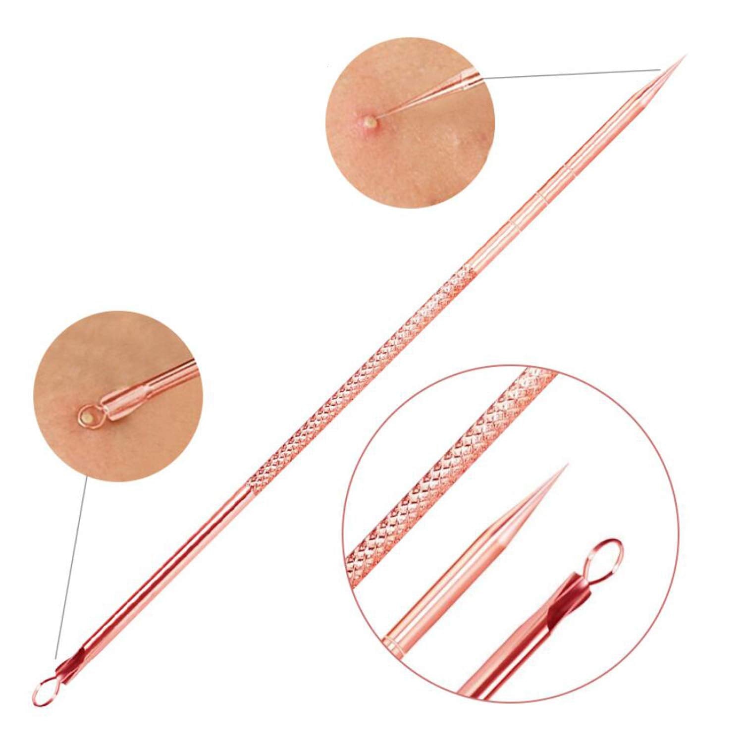 Essential Skin Care | Blackhead & Pimple Extractor Kit with Safe Extraction Tools | Professional Results at Home 6