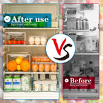 Fridge Organizer Set | Stackable BPA-Free Containers for Efficient Storage | Perfect for Fruits and Vegetables 5