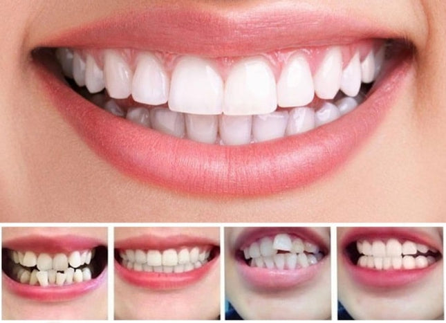Dental Trays 3 Step Set