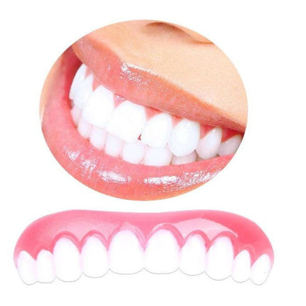 Thin Cosmetic Veneers, Teeth Cover for a Perfect Smile – image 5