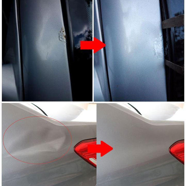 Paintless Dent Repair Kit, Suction Cup Car Dent Puller with Lever, Dent Removal Kit with Scraper for Car Body