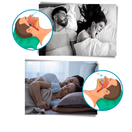 Anti Snoring Device, Mouthpiece for Snoring with Custom Fit