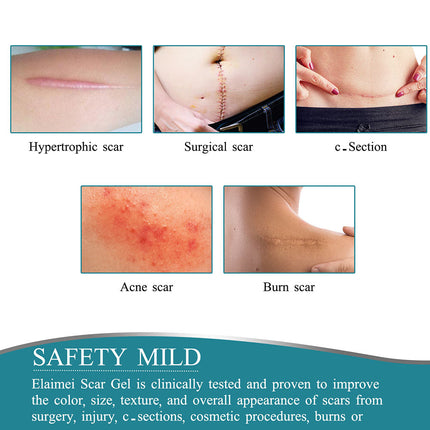 Silicone Scar Sheets Roll 4cm x 1.5m, Waterproof Scar Tape and Silicone Scar Strips – image 7