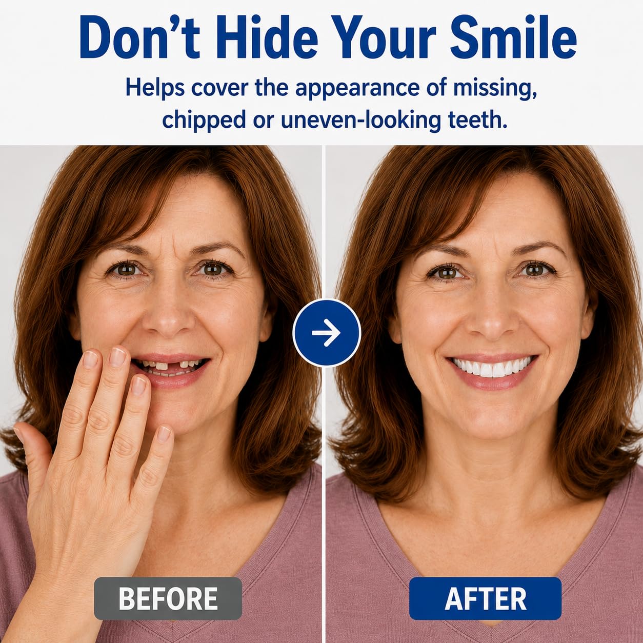 Moldable False Teeth Set | Temporary Dentures with Custom Fit | Instant Smile Transformation for Confidence 1
