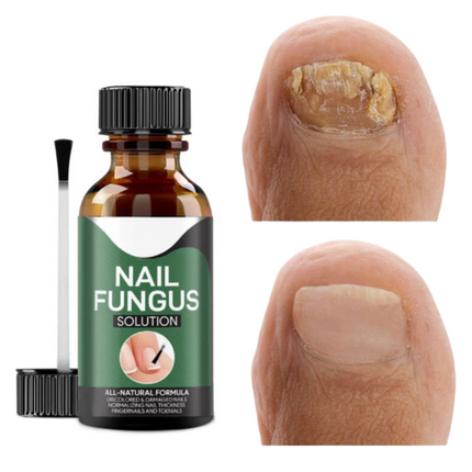Nail Serum for Toenail Fungus, Natural Nail Fungus Drops with Tea Tree Oil, Organic Nail Care Serum for Fingernails