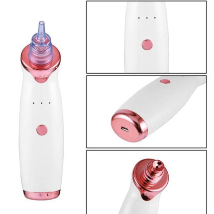 Pore Vacuum Blackhead Remover USB Rechargeable, Blackhead Vacuum with 3 Suction Levels and Diamond Head – media 6