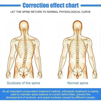 Posture Align | Customizable Spinal Alignment Support with Adjustable Fit | Enhanced Comfort for Daily Use 2
