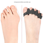 Tuzwa Gel Toe Separators for Bunions & Hammer Toes – Soft Silicone Toe Spacers for Alignment Support, Cushioning & Comfort, 1 Pair