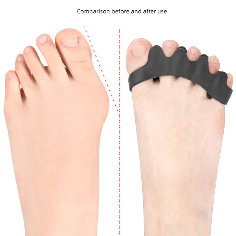 Tuzwa Gel Toe Separators for Bunions & Hammer Toes – Soft Silicone Toe Spacers for Alignment Support, Cushioning & Comfort, 1 Pair