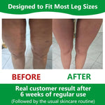 Sakerplus | Cellulite Massage Roller with 360° Deep-Tissue Action | Customizable Design for Enhanced Circulation 5