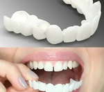 Tuzwa Removable Snap-On Teeth Cover – Reusable Polypropylene Cosmetic Dental Cover with Flexible No-Adhesive Fit
