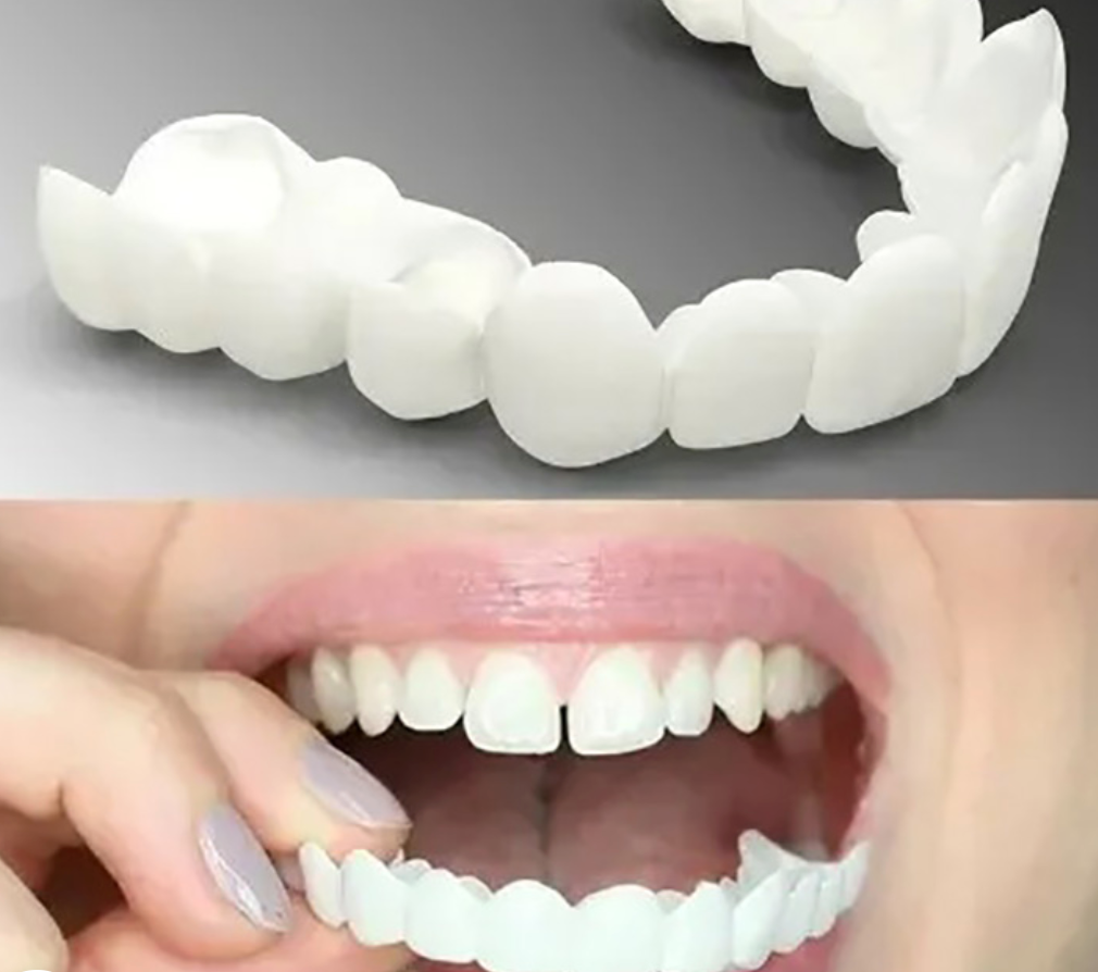 Tuzwa Removable Snap-On Teeth Cover – Reusable Polypropylene Cosmetic Dental Cover with Flexible No-Adhesive Fit