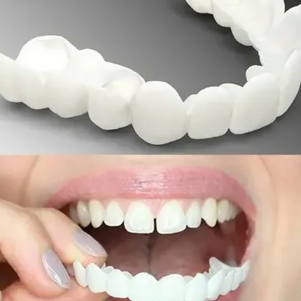 Snap On Teeth Veneers