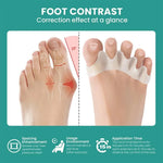 Tuzwa Soft Silicone Toe Separators – Cushioned Toe Spacers for Gentle Separation, Friction Reduction & Everyday Foot Comfort