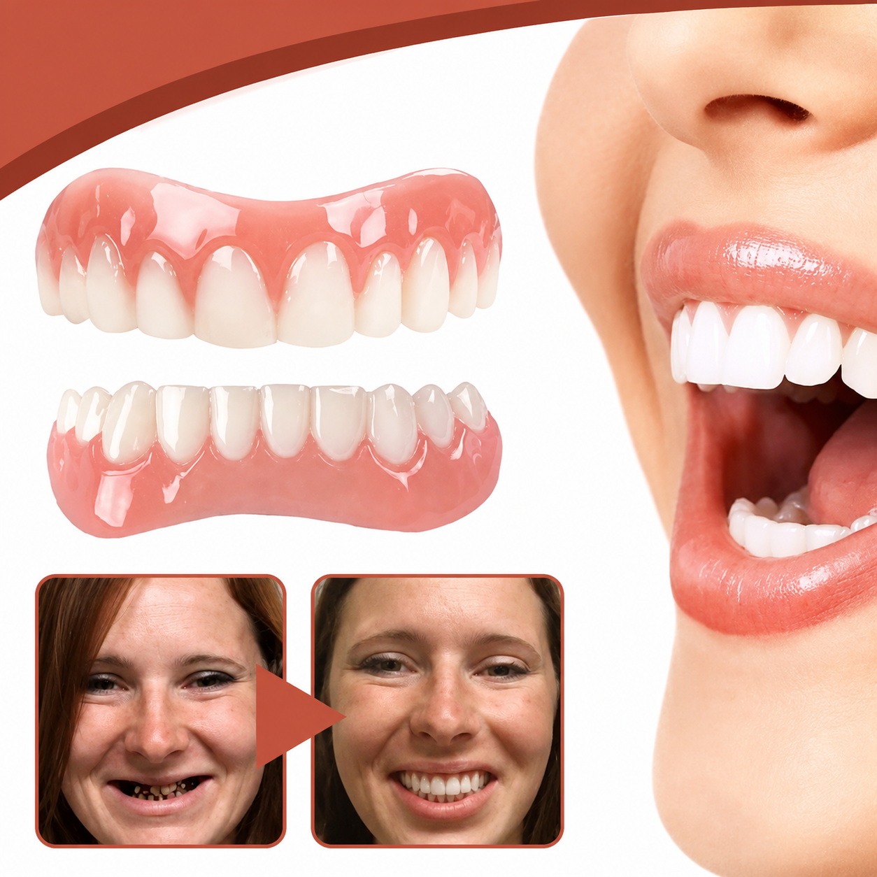 Silicone Dental Prosthetics | Biocompatible Custom Fit Solution | Natural Look for Confidence 3