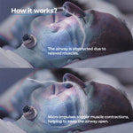 Sleep Aid | Anti-Snoring Chin Clip Device with Ergonomic Design | Comfortable Non-Invasive Support for Quieter Nights 1