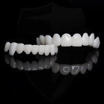 SmileLift | Dental Prosthesis with Customizable Lenses for Natural Appearance | Comfortable Fit for Everyday Confidence 5