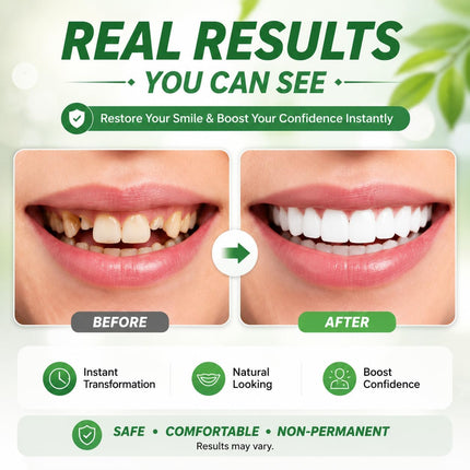 Smile Enhancer | Temporary Teeth Replacement Kit with Custom Fit | Natural-Looking Solution for Missing Teeth 4