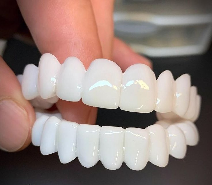 Smile Restore Dental Prosthetics with Custom Fit for Natural Confidence 0
